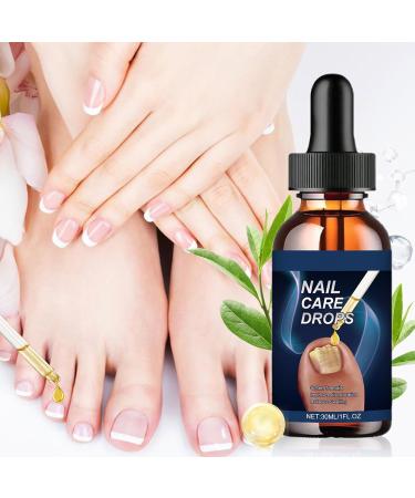Ingrown Toenail Treatment | 15ml Nourishing and Gentle Liquid Nail Care Drops For Dryness Redness Thickening Women's and Men's Home Manicure Pedicure Salon - Buy Online on GoSupps.com