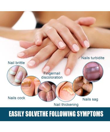 Shantou Youjia 2 pieces nail softening nail care care cream nail repair gel for foot nails nail care gel nail cream for damaged split and brittle nails regenerating - Buy Online on GoSupps.com