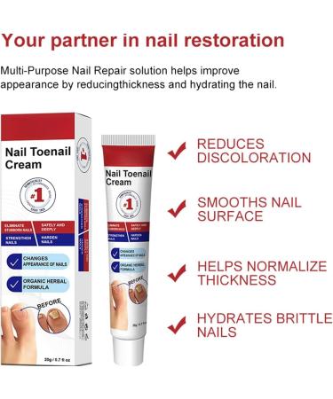 Fungal Nail Treatment Cream Antifungal Nail Polish Cream Nail Fungus Treatment for Toenail Strong Anti-Fungal Toenail Cream Nail Improve Cream Nail Repair Cream for Thick Cracked Discolored Nails - Buy Online on GoSupps.com