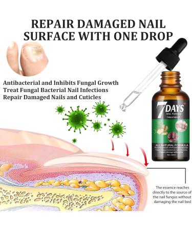Fungal Nail Treatment Nail Fungus Treatment for Toenail Fungal Nail Treatment for Toenails Extra Strong Protects Thick Broken Discolored Nails Restoring Healthy Nails - Buy Online on GoSupps.com