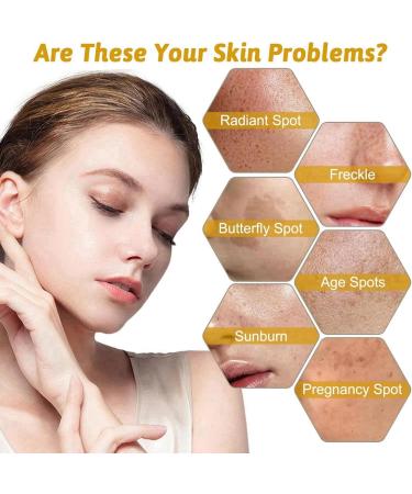 Face Moisturiser - Soothing & Barrier Support Serum Barrier Serum Skin Barrier Repair Cream Tightening Serum Serum Face Anti Redness Serum Facial Serum Face Moisturiser Serum Face Skincare Serum - Buy Online on GoSupps.com