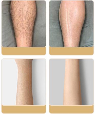 Exfoliation Hair Removal Tools User Friendly Crystal Eraser Hair Removal Multi-Purpose Magic Hair Eraser Device Epilator Manual Hair Eraser for Back Legs Women and Men Yellow - Buy Online on GoSupps.com