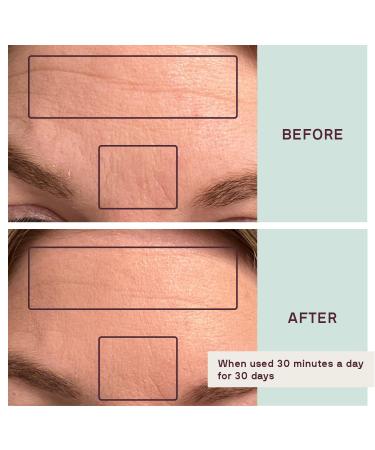 Buy Dermaclara Silicone Fusion Anti-Wrinkle Patches - Reusable Treatment for Fine Lines Under Eye Forehead & Neck Wrinkles - Pregnancy Safe Skincare Solutions - Buy Online on GoSupps.com