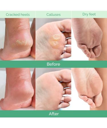 Plantifique Foot Peeling Mask - Combo 4 Pack for Soft & Smooth Feet - Buy Online on GoSupps.com