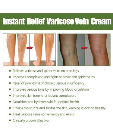 Varicose Vein Repair Cream for Effective Treatment of Varicose Veins Treatment Legs Cream Soothes and Moisturizes Quickly Cr me r paratrice veineuse (vert) / - Buy Online on GoSupps.com