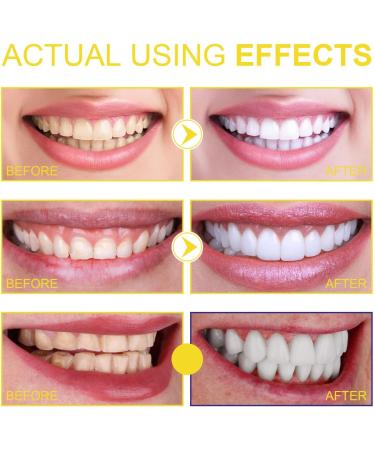 Propolis Oral Instant Treatment Spray | Furzero Propolis Oral Health Spray & Teeth Total Care Mouthwash - Buy Online on GoSupps.com