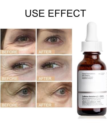 2PCS Caffeine Solution 5%+EGCG Eye Serum Caffeine Eye Serum Caffeine Eye Cream Anti Aging Under Eye Cream for Dark Circles and Puffy Eyes Instant Wrinkle Remover Eye Bag Removal Fade Fine Line 30ML - Buy Online on GoSupps.com