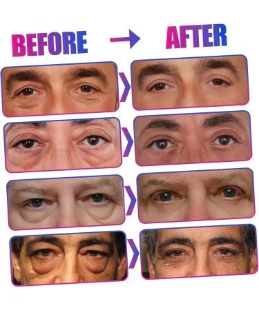 Beavorty 2 Eye Cream Anti-wrinkle Eye Gel Men Skin Care Supplies Moisturizer Soothing Abs Man - Buy Online on GoSupps.com