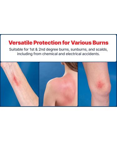 BurnFix Hydrogel Burn Spray 120ml | Instant Relief for 1st & 2nd Degree Burns Sunburns & Scalds | Doctor Recommended Soothing & Moisturizing Safe for All Ages - Buy Online on GoSupps.com