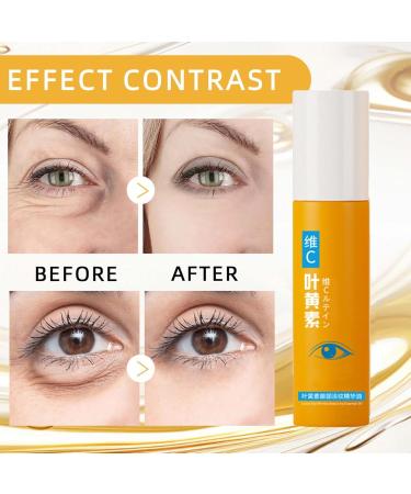 Luteine Yeux Lut ine Eye Oil VC Lut ine huile essentielle contour des yeux VC s rum anti-rides la lut ine s rum contour des yeux anti- ge pour l' limination des rides (8ML 1PC) 1PC 8 ml (Lot de 1) - Buy Online on GoSupps.com