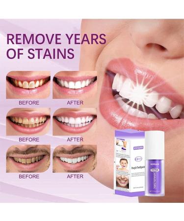  Voihamy Colour Corrector Purple Teeth Whitening Tooth Stain Removal Purple Toothpaste Colour Correcting Tooth Stains Tooth Colour Corrector 30 ml - Buy Online on GoSupps.com