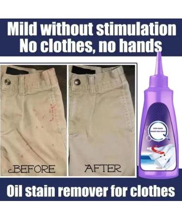 Active Enzyme Laundry Stain Remover Active Enzyme Clothing Stain Remover Active Enzyme Stain Remover White Shirt Guardian Garment Stubborn Stain Cleaner Oil Remover (3pcs-B) - Buy Online on GoSupps.com