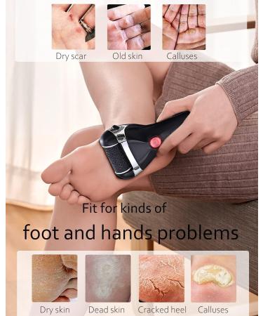 Jooayou Electric Foot File for Hard Skin - Rechargeable Callus Remover with 3 Rollers & 10-in-1 Foot Scraper Set - Buy Online on GoSupps.com