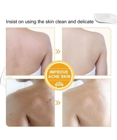 Lovelycat Savon de papaye claircissant la peau le savon de papaye contenant de l'acide hyaluronique r tinol am liore le teint in gal et hydrate le corps et le visage (2PC) - Buy Online on GoSupps.com
