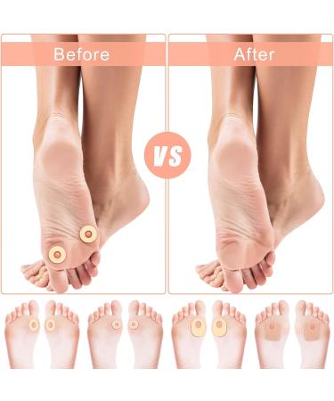 78-Piece Corn Pads Callus Cushions for Feet - Oval & U Shape Adhesive Foot Cushions for Men & Women - Reduce Pressure from Corns - 4 Styles - Buy Online on GoSupps.com