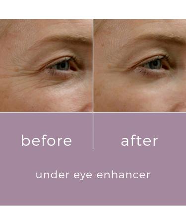 Skin Bunny Under Eye Enhancer Cream for Dark Circles & Puffy Eyes - Anti-Aging, Anti-Wrinkles, Caffeine Eye Serum - Men & Women - 20ml (1 Pack) - Buy Online on GoSupps.com