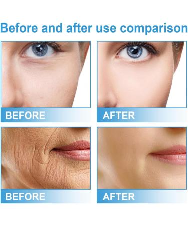 Face Serum for Women - 15% Niacinamide Serum - Hyaluronic Acid Serum for Face - Dark Spot Correcting Glow Serum - Moisturizing Collage Face Serum - Reduce Acne Nourish - Buy Online on GoSupps.com
