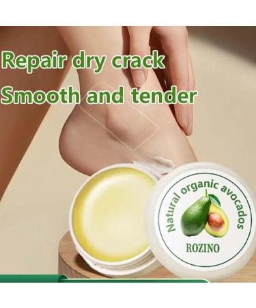 Avocado Foot Cream & Heel Balm for Dry Cracked Feet | Moisturizer for Corns Dead Skin & Soft Toenails - Perfect for Knees Elbows & Hands - Buy Online on GoSupps.com