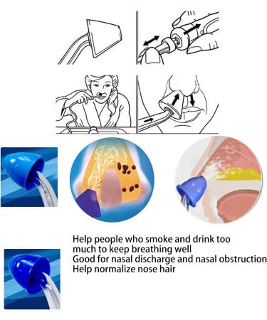 10pcs Soft Silicone Nasal Wash Head Replacement - Gentle Nose Rinse Cleaner for Mucus Removal - Buy Online on GoSupps.com