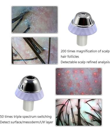 Hair Follicle Facial Skin Oil Moisture Tester Skin Hair Scalp Detector with 11 Inch 200x Lens 50x Lens Pixels 1000W ABS Resin Hair Follicle Testing and Skin Analysis Magnifier - Buy Online on GoSupps.com