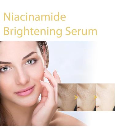 KOAHDE Nicotinamide Brightening Essence Nicotinamide Moisturizing Serum Whitening Anti-Aging Essence Moisturizing and Brightening Skin Nicotinamide Skin Brightening Essence Moisturizing & Rejuvenating - Buy Online on GoSupps.com