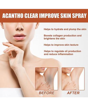 NEUKIN Acantho Clear Therapy Spray - Acanthosis Nigricans Treatment 2Count (Pack of 2) - Buy Online on GoSupps.com
