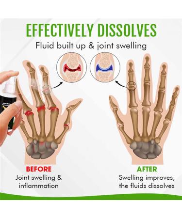 Natural Herbal Lumbar & Joint Pain Relief Spray for High Heel Shoes - 4pcs - Buy Online on GoSupps.com