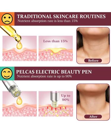 PELCAS Microneedling Pen Automatic Serum Applicator Microneedling 5 Speeds with LCD Screen Type-C Rechargeable Cordless Dermapen for Scars Wrinkles Acne Stretch Marks Skin Rejuvenation - Buy Online on GoSupps.com