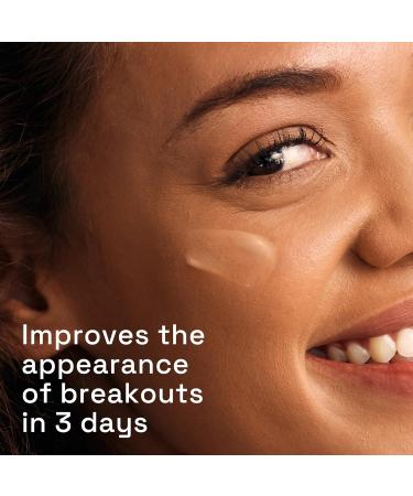 Cetaphil Gentle Clear Triple-Action Blemish Serum 30ml with 0.5% Salicylic Acid and Niacinamide for Blemish-prone Sensitive Skin - Buy Online on GoSupps.com