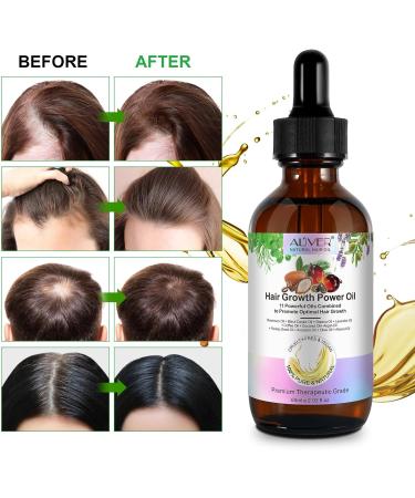 SIKOT Hair Growth Oil With Rosemary Oil Castor Oil Batana Oil and Coconut Oil Mixed Hair Growth Oil to Help Hair Grow Hair Oil for Helps to Grow Hair Strengthen Hair and Get Healthy Scalp - 60ML - Buy Online on GoSupps.com