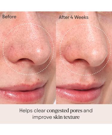 Alpyn Clarifying Facial Oil with Retinol & Pink Algae | Clear Congestion Smooth Fine Lines & Boost Radiance | 1 Fl Oz - Buy Online on GoSupps.com