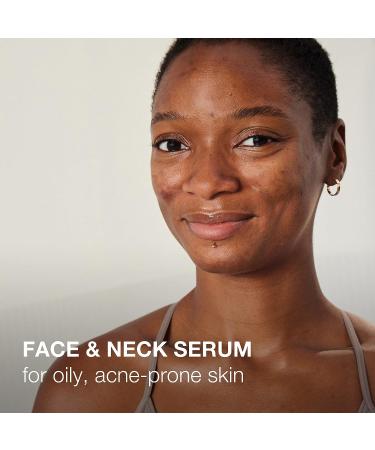 Neutrogena Stubborn Texture Resurfacing Serum 10% Niacinamide 4% Neoglucosamine for Acne-Prone Skin | Improves Uneven Tone, Refines Texture | 1 fl. Oz - Buy Online on GoSupps.com