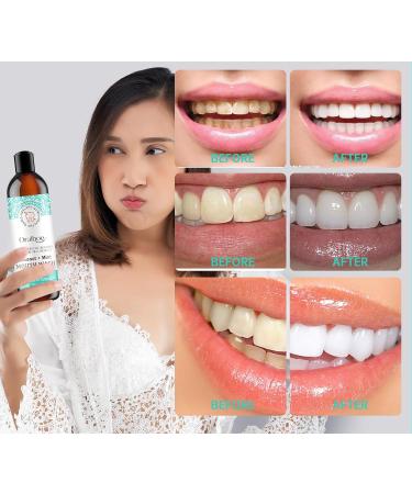 Coconut Oil Pulling Mouthwash with Tongue Scraper - Natural Alcohol-Free Mouthwash for Teeth & Gums (3.3 Fl Oz) - Pack of 1 - Buy Online on GoSupps.com