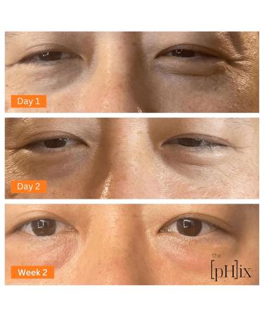 Caffeine Eye Cream | Hyaluronic Acid & Vitamins E & K | Vegan Solution for Dark Circles Puffiness Wrinkles | International Shipping - Buy Online on GoSupps.com