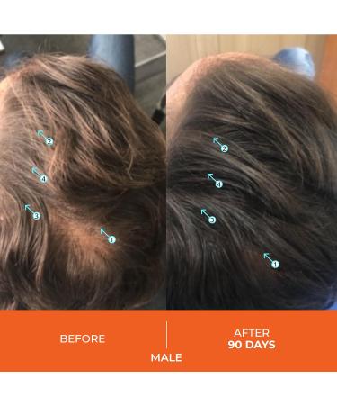 DS Laboratories Revita Thickening Shampoo and Conditioner Set Promotes Hair Growth Sulfate Free Biotin Caffeine & DHT Blocker Hair Care - Buy Online on GoSupps.com