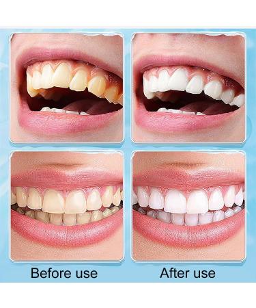 SHUBEIEUMI Tartar Remover - 3 Pack Professional Teeth Cleaning Brush for Stain & Discoloration Removal - Fast International Shipping - Buy Online on GoSupps.com
