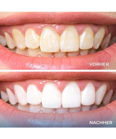 High-Quality Tartar Remover & Dental Care Set for Dogs | Tooth Cleaning Tools with Mouth Mirror & Scaler - International Shipping Available - Buy Online on GoSupps.com