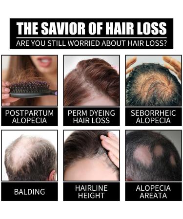 Hair Oils for Hair Growth Hair Lotion for Strong and Thick HairBiotin and collagen for natural hair growth Antihair loss Nourishes and repairs dry damaged hair Eastuy - Buy Online on GoSupps.com