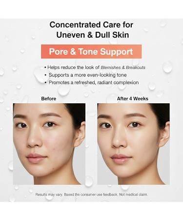 Niacinamide Serum for Face - 15% Niacinamide with Vitamin C Glutathione - Korean Dark Spot Serum for Uneven Tone Enlarged Pore Dullness Ance-Prone Sensitive Skin - Fragrance-Free Daily Use - Buy Online on GoSupps.com