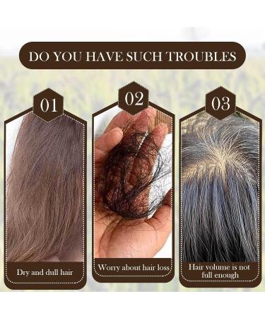 S rum de Croissance des Cheveux Essence Croissance des Cheveux Spray Nourrissant Au pour Croissance des Cheveux Pousse Cheveux Tr s Rapide Stoppe la Chute des Cheveux et L'amincissement - Buy Online on GoSupps.com