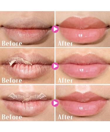 KIMUSE Lip Mask Set Lip Sleeping Mask Overnight Lip Treatment for Dry Lip Flaky Moisturizing Vitamin C Shea Butter & Antioxidants - Buy Online on GoSupps.com