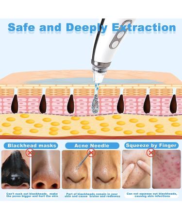 Tunbot Blackhead Remover Pore Vacuum Cleaner - Powerful Whitehead Removal Tool with 4 Probes | Rechargeable Black Head Suction Tool for Acne-Prone Skin - Buy Online on GoSupps.com