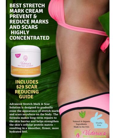 Best Stretch Marks Cream - Prevent & Reduce Pregnancy Marks | Highly Concentrated Formula + Free $29 Scar Reducing Guide - International Shipping Available - Buy Online on GoSupps.com