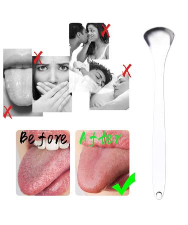 Kare & Kind 3x Stainless Steel Tongue Scraper - High-Quality Oral Cleaner for Home & Travel | Reduces Bad Breath & Improves Oral Health - Buy Online on GoSupps.com