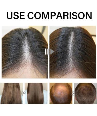 Hair Growth Spray Hair Growth Oil with Biotin Hair Thickening Spray Nourishes Hair & Scalp Anti Hair Loss Serum for Thicker Longer & Stronger Hair 30ML - Buy Online on GoSupps.com