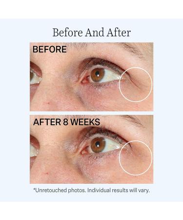 StriVectin Contour Restore Firming Moisture Balm for Eyes 0.5 oz - Anti-Aging Eye Cream - Buy Online on GoSupps.com
