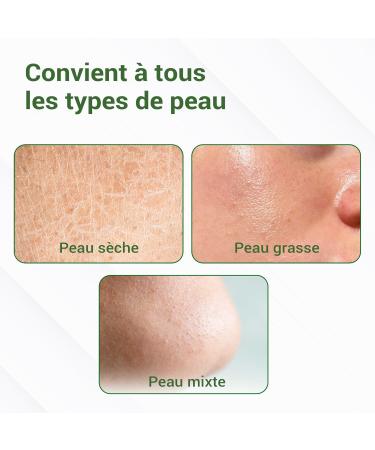 S rum v g talien au r tinol pour le visage - S rum anti- ge l'acide hyaluronique vitamine E et aloe vera pour lutter contre les rides les taches de vieillesse les taches pigmentaires les ridules - Buy Online on GoSupps.com