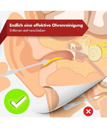 Neumann Reusable Stainless Steel Ear Cleaning Set | Premium Ear Wax Remover with Handy Storage Box Loop Spiral & Spoon Shapes Silver Ear Cleaner for Adults - Buy Online on GoSupps.com