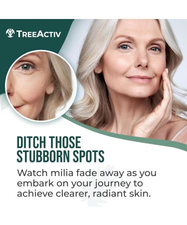 TreeActiv Spot Treatment  - Milia - 0.5 Fl Oz  - Pack Of  2 - Buy Online on GoSupps.com