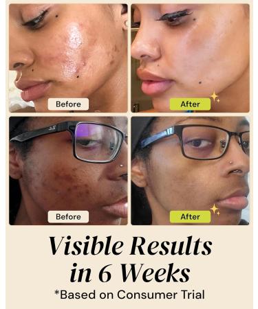 Gleamin Brightening Skincare Bundle Mask Serum Cleanser Moisturizer & Oil for Dark Spots Uneven Tone and Glowing Skin Complete Vitamin C Skincare Routine - Buy Online on GoSupps.com